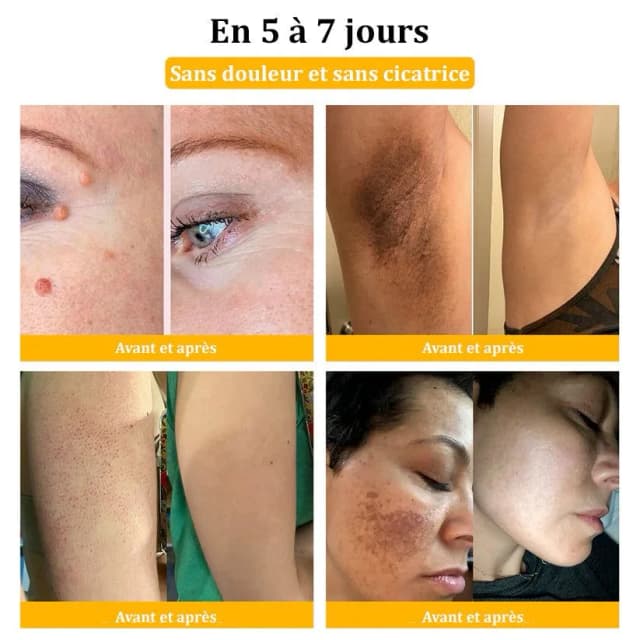 Image du produit